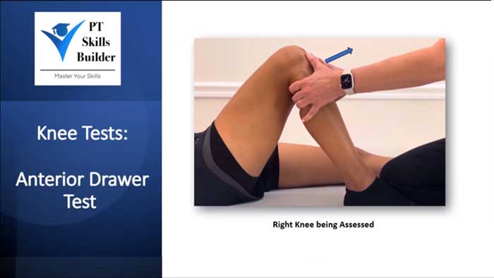 anterior drawer test | 半月板損傷 整形外科的テスト – CRXB